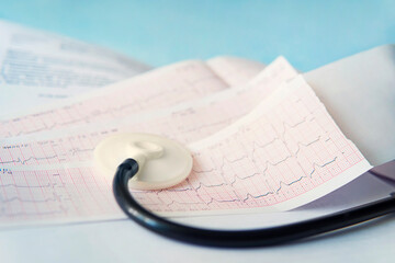 Medical stethoscope lying on cardiogram chart closeup on a blue background. Medical help, prophylaxis, disease prevention or insurance concept. Cardiology care, health, protection prevention