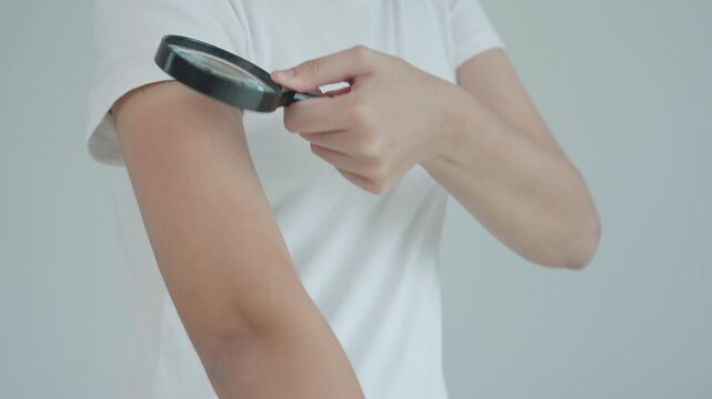 skin problem and beauty. asian woman use magnifying glass look itchy skin from skin allergic, shocked, steroid allergy, sensitive, chemical allergy, rash, insect bites, Seborrheic Dermatitis.
