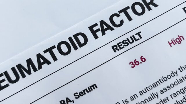 Rheumatoid factor report of a patient concept design 4k footage close up. Health, medical.