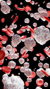 Chronic myelogenous leukemia (CML) In Bloodstream , Acute lymphoblastic leukemia (ALL), white blood cells (WBC), cancer of the white blood cells