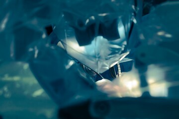 A scene captures a minimally invasive surgical procedure, viewed through the lens of robotic instrumentation, highlighting the blend of precision and medical expertise within the operating room