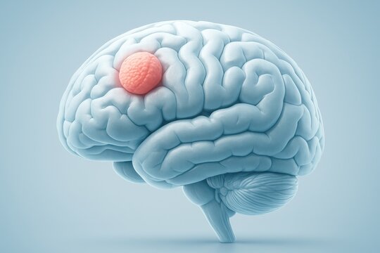 Detailed 3D rendering of the human brain highlighting a meningioma tumor on the meninges, ideal for medical education, diagnosis explanation, and neurology concepts.
 - Powered by Adobe