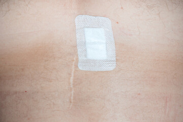 Post-surgery bandage over long healed scar