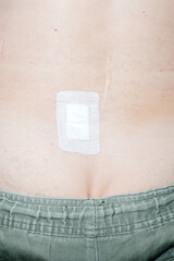 Medical bandage on lower back after procedure