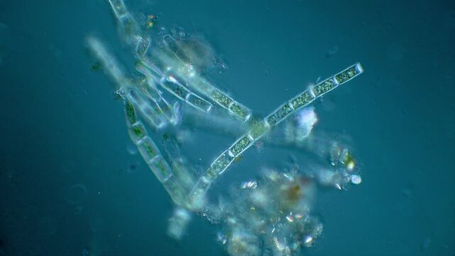 Green algae filaments under microscope