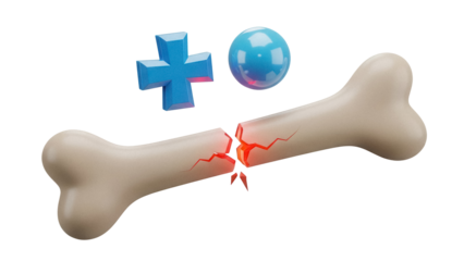Broken bone isolated PNG on transparent background, medical concept with blue cross and sphere, fracture and injury treatment