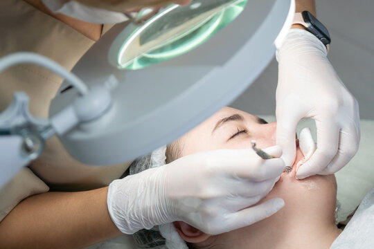 Dermaplaning Treatment Clinic Facial Hair Removal: Professional skincare procedure removing facial hair using a scalpel.