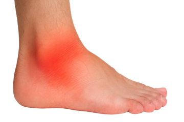 Ankle joint pain inflammation isolated on white background
