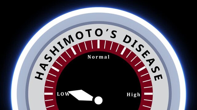 Hashimoto's Disease Severity Gauge Indicator Showing High Level on Black Background meter