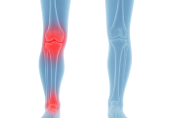 Knee and ankle joint pain highlighted on leg isolated on white background