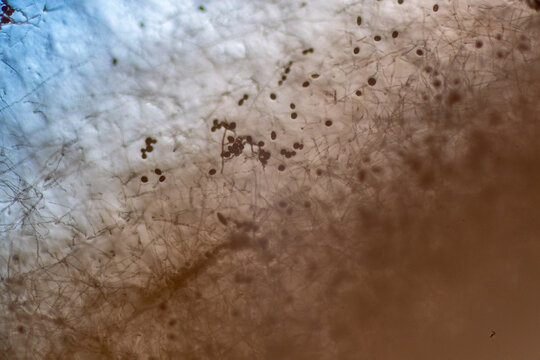 Microscopic View of Septate Dematiaceous Fungal Hyphae and Possible Chlamydospo