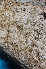 Microscopic View of Septate Dematiaceous Fungal Hyphae and Possible Chlamydospo