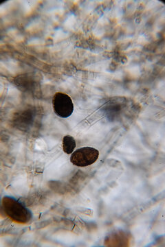 Microscopic Visualization of Darkly Pigmented Fungal Conidia and Hyphal Structures in a Clear Wet Mount