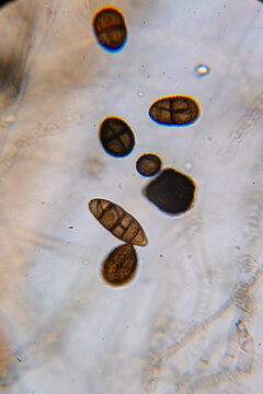 Dematiaceous Fungal Spores Exhibiting Transverse and Longitudinal Septation, Likely of the Genus Alterna