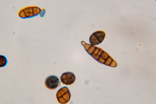Dematiaceous Fungal Spores Exhibiting Transverse and Longitudinal Septation, Likely of the Genus Alterna