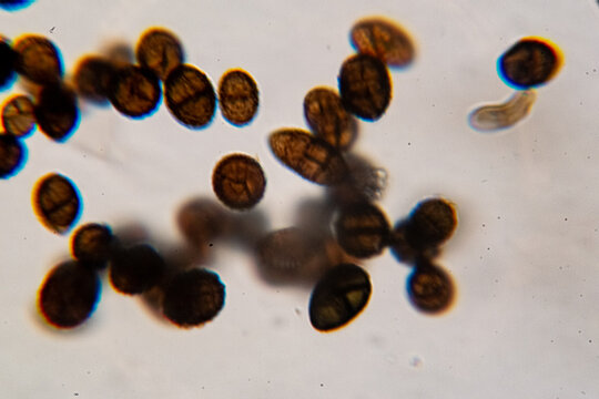 Dematiaceous Fungal Spores Exhibiting Transverse and Longitudinal Septation, Likely of the Genus Alterna