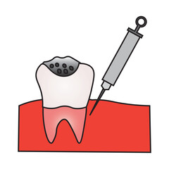 Dental Cavity Treatment with Local Anesthesia Injection