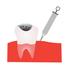 Dental Cavity Treatment with Local Anesthesia Injection