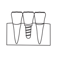 Dental Implant and Tooth Replacement line icon 