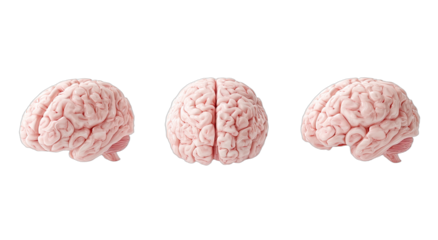 Three pale pink human brains shown from different angles against a black background