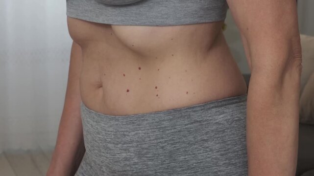 An adult woman doing abdominal exercises. She pulls in and releases her stomach, attempting "Nauli" (vacuum exercises). She makes a "wave" with her abdominal muscles. Angiomas on the skin.