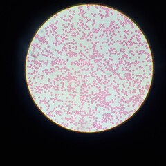 Red and White Blood Cells Under Microscope View
