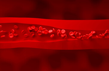 High blood pressure (Hypertension) - Front view 3d illustration