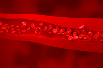 High blood pressure (Hypertension) - Isometric view 3d illustration