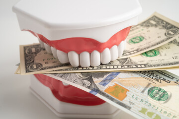 Treatment dental care cost, dental expense or fee, Euro banknote money with teeth model.