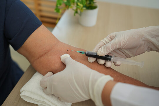 Close up of doctor or nurse taking blood sample from arm vein with vacutainer. syringe to venipuncture the patient - Powered by Adobe