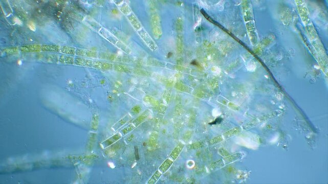Green algae filaments under microscope