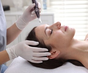Woman undergoing microneedling procedure in beauty salon, closeup