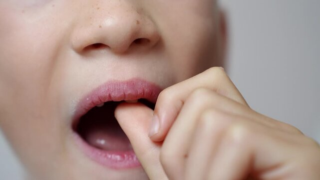 Child carefully examines loose tooth, touching it with finger, feeling anxiety about painful and sensitive gums, first signs of teething appear