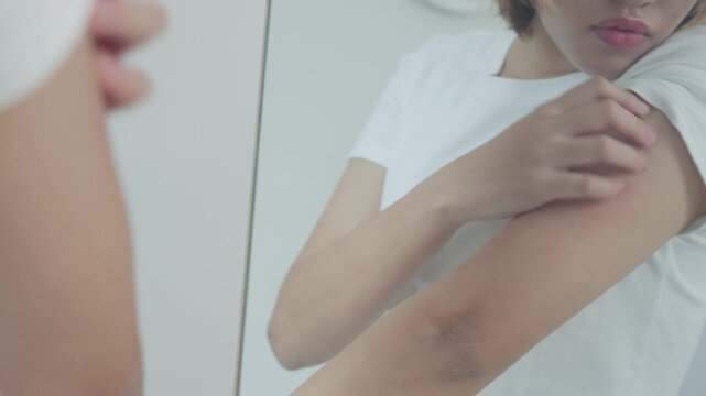 skin problem and beauty. Young woman scratch body has itchy skin from skin allergic, steroid allergy, sensitive skin, red from sunburn, chemical allergy, rash, insect bites, Seborrheic Dermatitis.