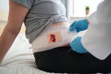 Medical professional changing abdominal wound.