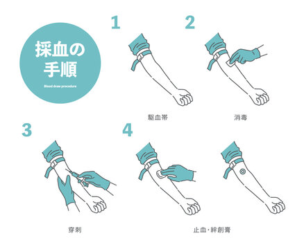 採血の手順イラスト（駆血帯・消毒・穿刺・止血）