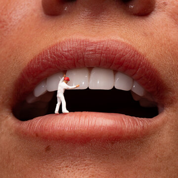 Facet implementation
miniature sur l&egrave;vre feminine
