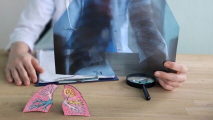 Doctor examines X-ray of lungs while using magnifying glass and reviewing charts in a medical office