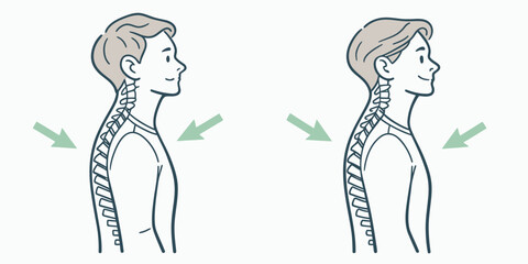 Shoulder and Neck Posture Correction Illustration shoulders
