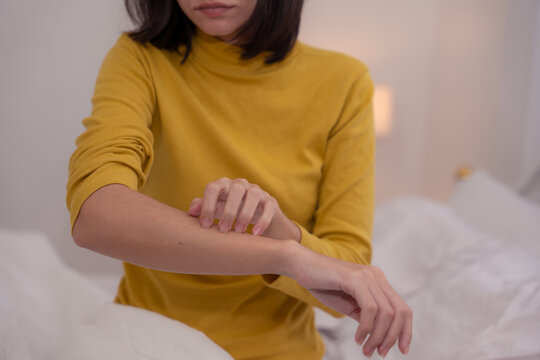 Close-up of a woman scratching her forearm, showing symptoms of itchy skin, allergy, irritation, or dermatitis, concept of skin problems, allergic reaction, and personal health care at home.