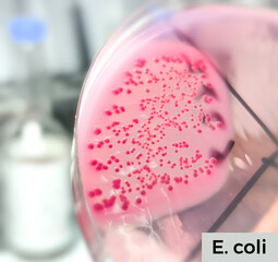 A microbiological culture Petri dish with a colonies of the pathogenic bacterium Escherichia coli (E. coli)