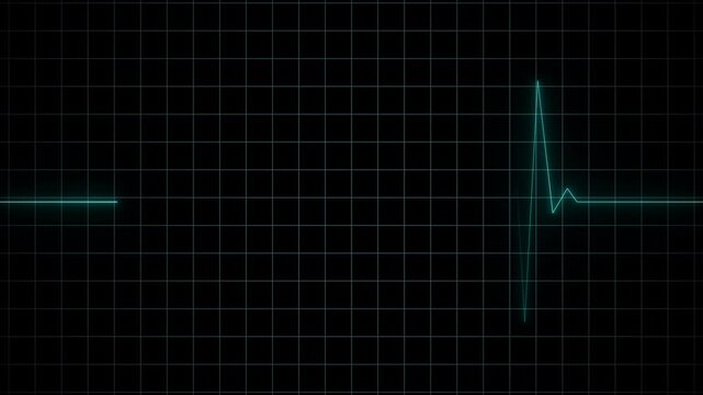 Animation of Endless loop EKG Heart Monitoring display. Full HD. 4K