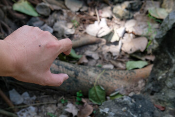 Mosquito bite marks on skin during forest travel, showing natural outdoor conditions and adventure