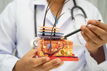 Asian dermatologist doctor holding skin structure model anatomy for treatment in hospital, hair transplant.