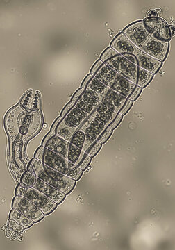 Segmented Filamentous Organism