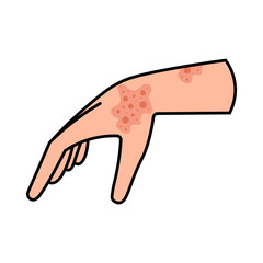 Dermatitis Icon