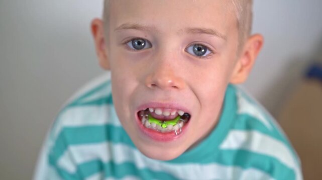 Dentist test setting of palatal braces for young patient in child's mouth. Jaw correction