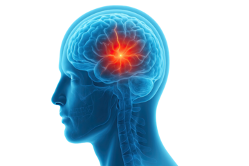 Side view anatomical illustration of human head showing glowing inflamed brain region with highlighted central pain point isolated on white background