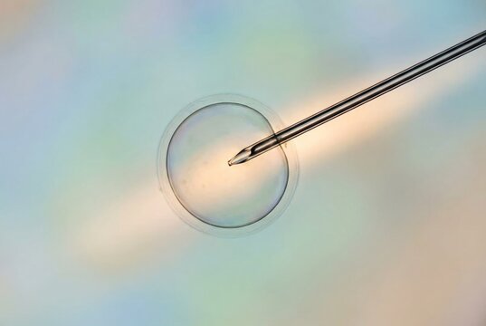Embryologist performing intracytoplasmic sperm injection - icsi - or assisted hatching on an egg cell, representing in vitro fertilization procedures and fertility treatment for human reproduction