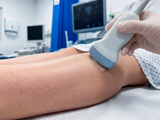 Close-up of an ultrasound probe scanning a patients leg during a vascular exam. Detailed skin texture and clean clinical setting with soft lighting. No faces visible, sterile medical atmosphere